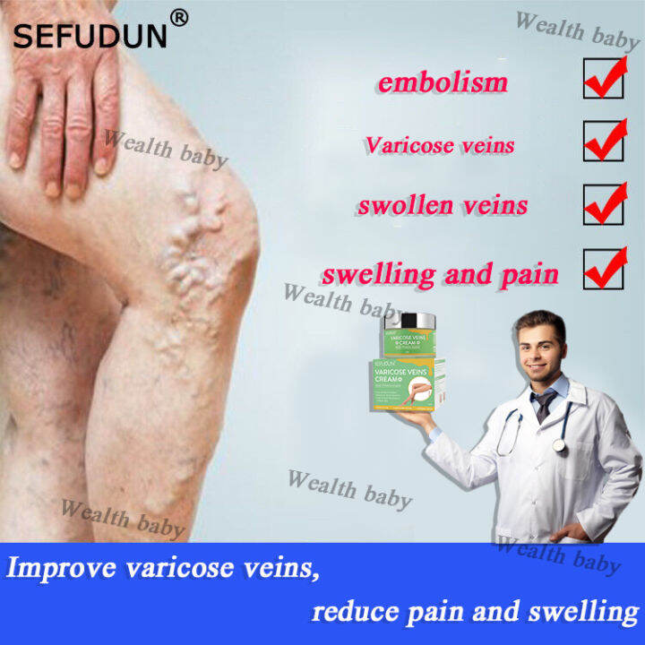 Original SEFUDUN Varicose Vein Cream With Cooling Effect,Veins Cream ...