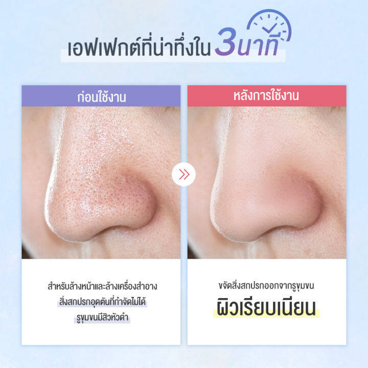 ems-เครื่องทำความสะอาดใบหน้าลึก-ครื่องดูดสิว-ultrasonic-skin-scrubber-เครื่องขัดผิวอัลตร้าโซนิค-เครื่องดูดสิว-ลอกสิวเสี้ยน-อัลตรา-โซนิก-เครื่องสครับผิวหน้าด้วยไอออน