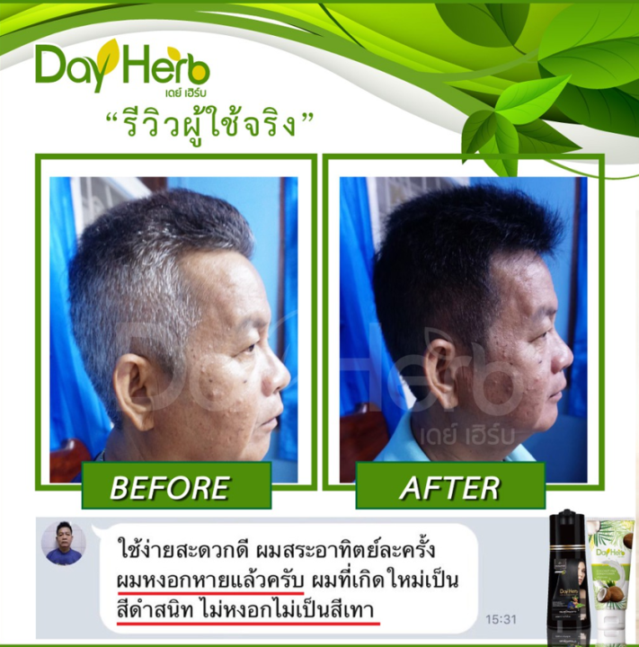 ชุด-1-แถม-1-dayherb-แชมพูปิดผมขาว-สมุนไพรแท้-ปิดหงอก-ลดหงอก-ผมดำใน-5-นาที