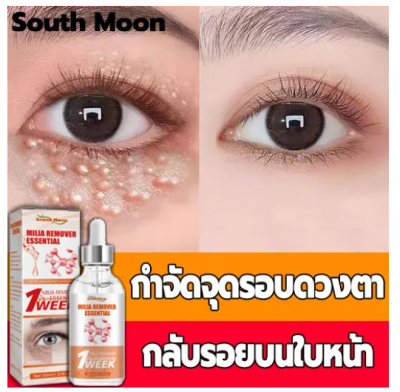 🔥พร้อมส่ง🔥South Moon ครีมกำจัดถุงใต้ตา 30ml ครีมบำรุงใต้ตา เซรั่มทาถุงใต้ตา กระชับรอยตีนกา บรรเทาปัญหาต่างๆรอบดวงตา (คนีมบำรุงรอบดวงตา ครีมทาตาเม็ดไขมัน ​ครีมบำรุงรอบตา ​เซรั่มถุงใต้ตา ​ครีมทาใต้ตาดำ บำรุงสายตา ครีมทาตาดำ）