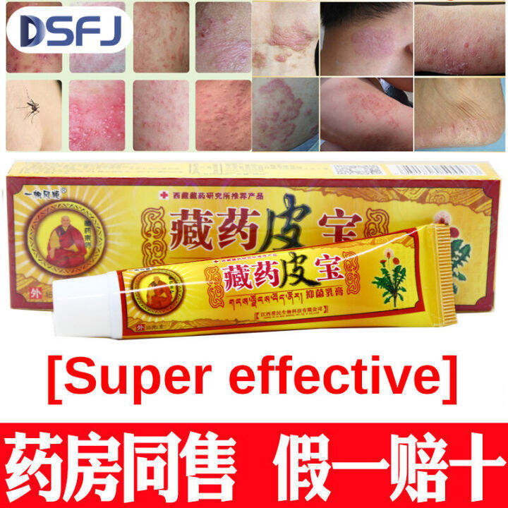 藏药皮宝 Eczema Treatment Anti Bacterial Skin Fungus 真菌感染 Cream Ekzema ...