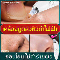 DermaSuction เครื่องดูดสิว เครื่องดูดสิวไฟฟ้า ช่วยทำความสะอาดสิวหัวดำ(เครื่องดูดสิวไมโครคริสตัล,ที่ดูดสิวไฟฟ้าดูดสิว,เครื่องดูดสิวหัวดำ,เครื่องดูดสิวเสี้ยน,เครื่องมือ Blackhead)