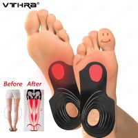 【YF】 Orthopedic Insoles Arch Support Flat Foot O/X Legs Correction Orthoses Pads Massaging Shoe Care Unisex