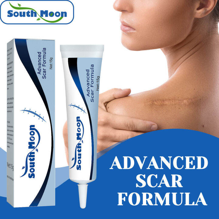 South Moon Wound And Scar Repairing Cream Acne Spots Stretch Marks