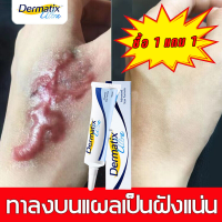 ?ซื้อ 1 แถม 1? ครีมทาแผลเป็น ครีมแผลเป็น เจลซ่อมแซม เจลรอยแผลเป็น รอยแผลเป็น รอยแผลเป็น แผลผ่าตัด น้ำร้อนลวก ครีม