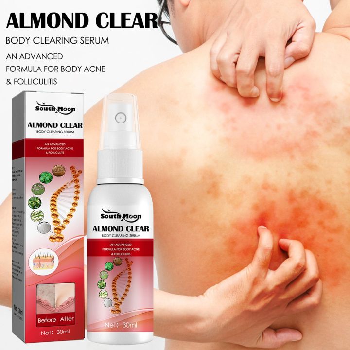 uclanka-body-clearing-serum-spray-clearing-serum-for-back-butt-chest-thighs-shoulders-face-armpits-ac-ne-folliculitis-bumps-pimples