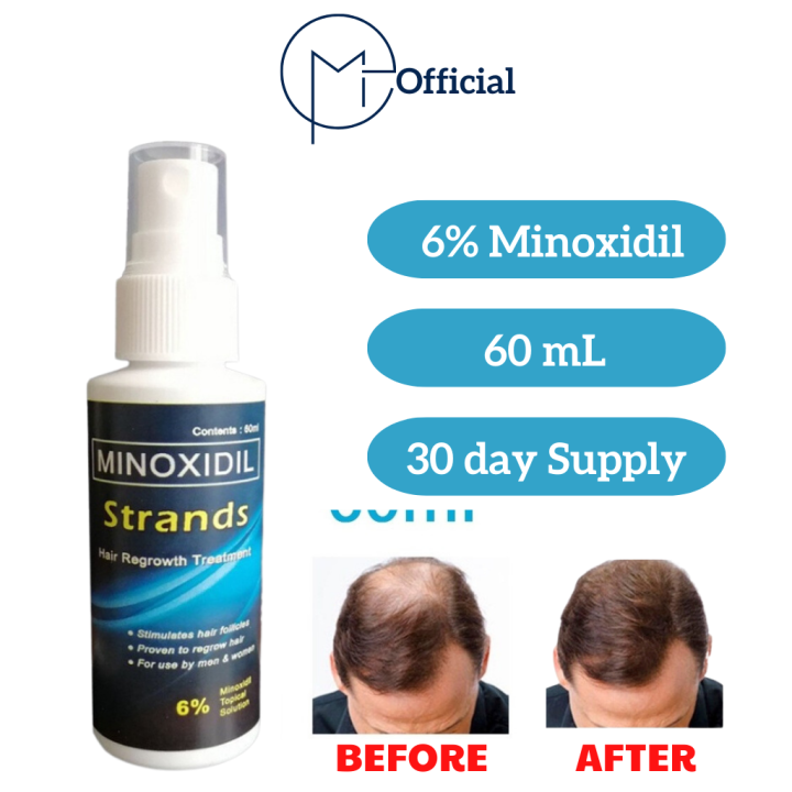 Minoxidil Strands 6% Minoxidil Topical Solution (60ml per bottle) Hair ...