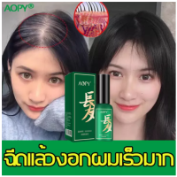 สารสกัดจากพืช AOPY น้ำยาปลูกผมดก สเปรย์ปปลูกผม น้ำยาปลูกผม เซรั่มปลูกผม เซรั่มบำรุงผม 30ml