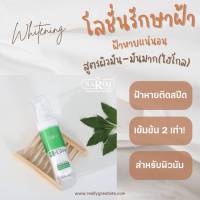 โลชั่นรักษาฝ้า ดร.สาโรช ไฮโกล (Dr. Saroj Hi-Glow) สำหรับผิวมันมาก  สูตรเข้มข้น 2 เท่า