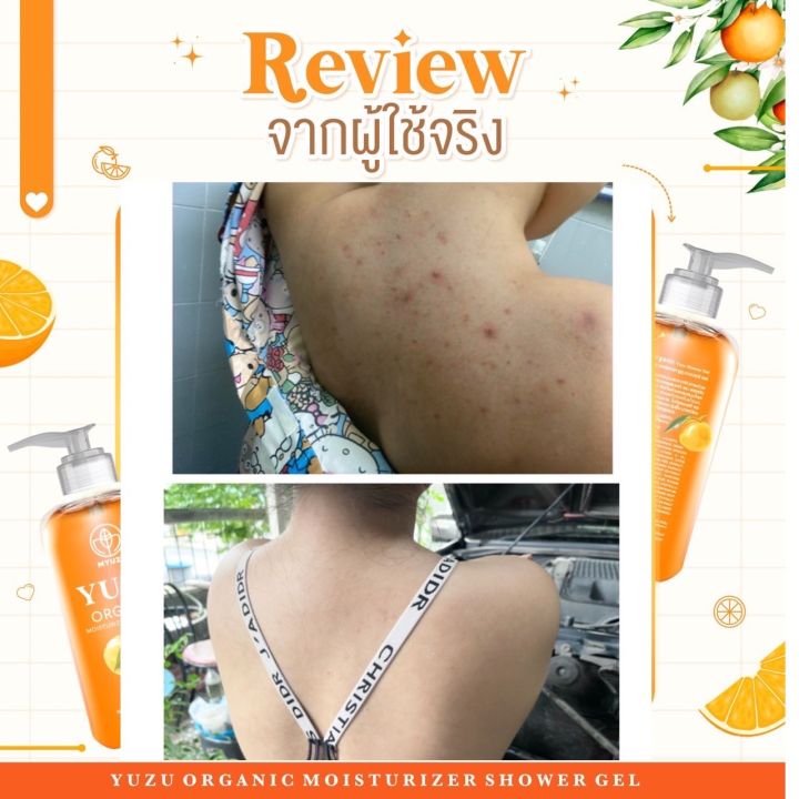 พร้อมส่ง-ลดสิวที่หลัง-เจลอาบน้ำมิวซุ-organic-มี-biosol-ช่วยฆ่าเชื้อสิว-ลดรอยดำ-ผดผื่น-สิวหลัง-สิวหน้าอก