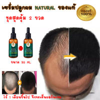 เซรั่มปลูกผม 2 ขวด ยาปลูกผม ผมร่วง เซรั่มเร่งผมยาว ขนาด 30 ML ป้องกันผมร่วง พร้อม เร่งให้เกิดผมใหม่ ของแท้ 100% ไม่พอใจยินดีคืนเงิน