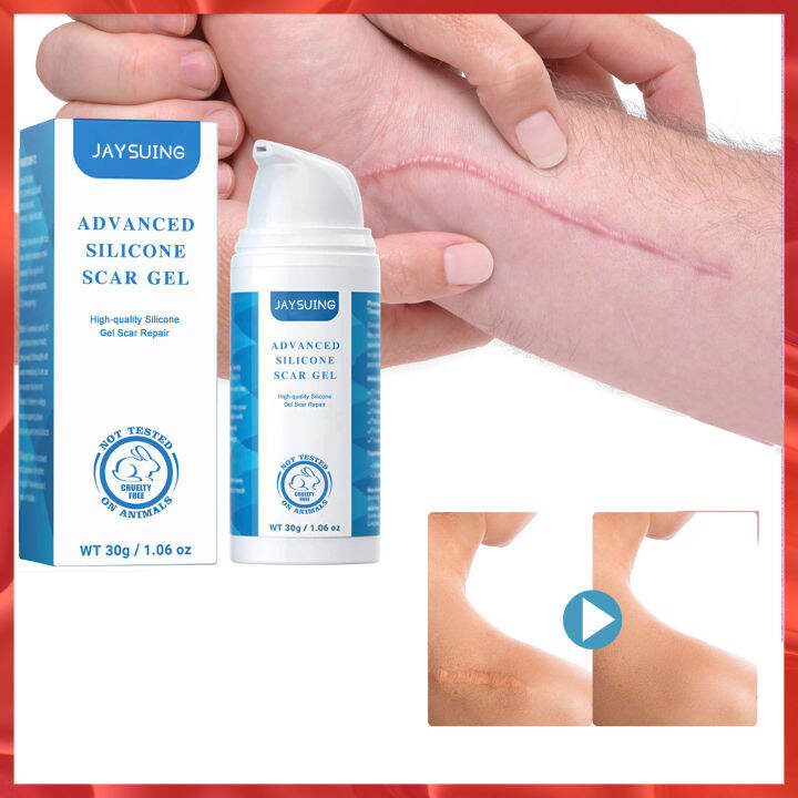 Jaysuing Fast Scar Remove Cream Treatment Stretch Mark Burn Fade Acne