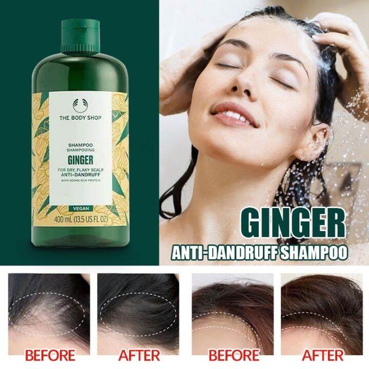 British Anti Dandruff Shampoo Hairfall Oil Hair Growth Lazada PH