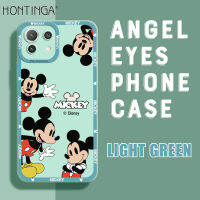 Hontinga เคสโทรศัพท์ Xiaomi MI 11 Lite 4G 5G 11 Lite 5G NE,เคสการ์ตูนอนิเมะมิกกี้เมาส์สี่เหลี่ยมฝาปิดเต็มกล้องเคสยางกันกระแทกเคสฝาหลังเคสใส่โทรศัพท์นิ่มสำหรับเด็กผู้หญิง