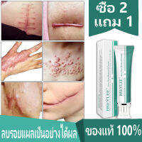 Breylee ของแท้ ลบรอยแผลเป็น ครีมทาแผลเป็น ครีมลบแผลเป็น scar removal cream ยาทาแผลคีลอยด์ ครีมทาแผลผ่าคลอด ลดแผลไฟไหม้ แผลน้ำร้อนลวก แผลผ่าตัดเป【ลบรอยแตกลาย รอยแผลผ่าคลอด แผลผ่าตัด น้ำร้อนลวกไฟไหม้ รอยแผลเป็น สิวผด สิวอักเสบ】