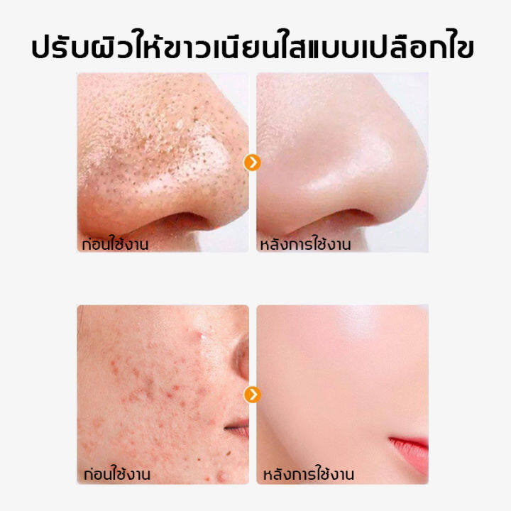 จัดส่งจากกรุงเทพฯ-สลีปปิ้งมาส์ก-มาส์กหน้าขาวใส-คอลลาเจน-มาส์กหน้า6g-10ห่อ-ทำความสะอาดอย่างล้ำลึก-ทำความสะอาดรูขุมขน-สิวหัวดำ-สิว-ผิวนุ่มชุ่มชื่น-ดูเปล่งปลั่ง-โคลนมาส์กหน้า-แผ่นมาส์คหน้า-ผงมาร์คหน้า-คร