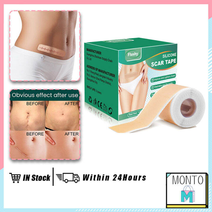 1.5M/Roll Silicone Scar Tape Width 4cm Effectively Smooth Injuries