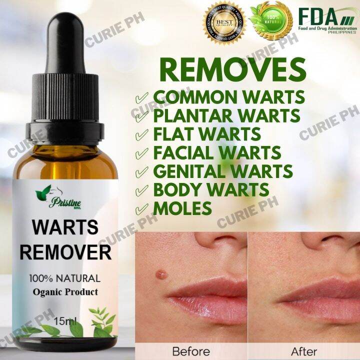 CPH 100 Pure Organic Kasoy Oil + Salicylic Acid Pristine MNL Painless