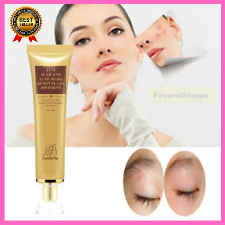 [ALL IN BEST CHOICE] Buy 1 Take 1 TCM Scar Removal Cream Acne Treatment ...