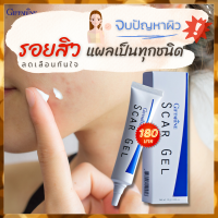 สการ์เจล scar gel เจลทารอยสิว เจลรอยแผลเป็น เจลรอยสิว ลบรอยแผลเป็น ลบรอยแผลเป็นสิว รอยแผลเป็นนาน  สินค้ากิฟฟารีน