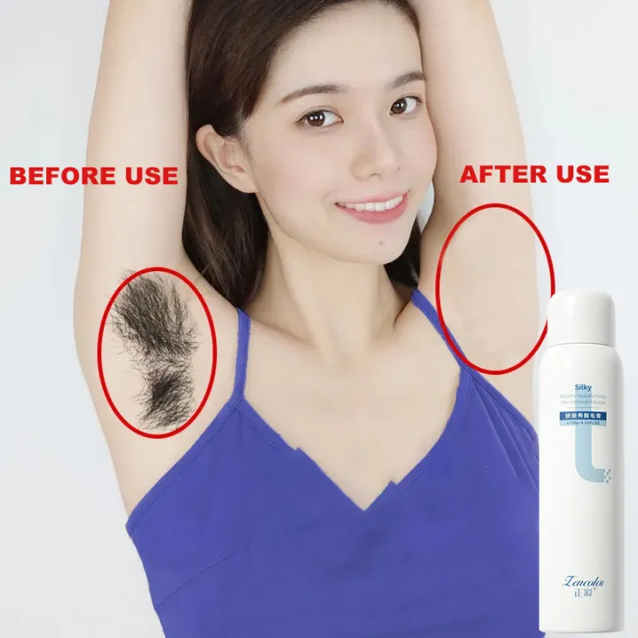 Hair Removal Spray Foam Mousse Nonpermanent Removal of the Whole Body