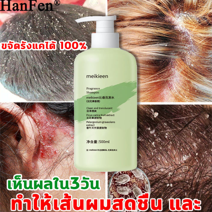 meikieen-แชมพูขจัดรังแค-500ml-ควบคุมความมันและกำจัดรังแค-รากผมแข็งแรง-ฟองละเอียด-กำจัดผมชี้ฟู-แก้ปัญหาตั้งแต่ต้นตอของหนังศีรษะ-ยาสระผมรังแค-ยาสระผมเชื้อรา-ยาสระผมแก้คัน-เชื้อราบนศีรษะ-แชมพูแก้คันหัวแช