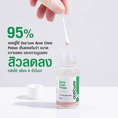 oxecure-acne-clear-potion-15ml-โพชั่นแต้มสิว