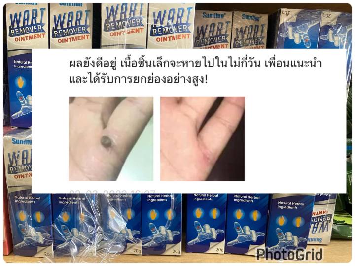 พร้อมส่งส่งฟรี-ครีมทาหูดไฝติ่งเนื่อ-บำรุงผิว-ขนาด-20-กรัม