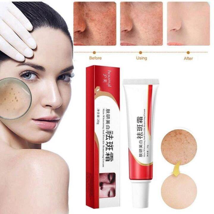 2 In 1 Effective Melasma Cream Pekas Remover Skin Whitening Moisturizer