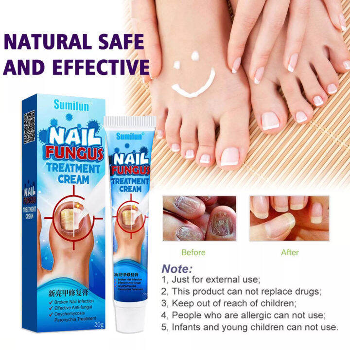 20g SUMIFUN Nail Treatments Nail Repair Liquid Nail Care Cream Nail ...