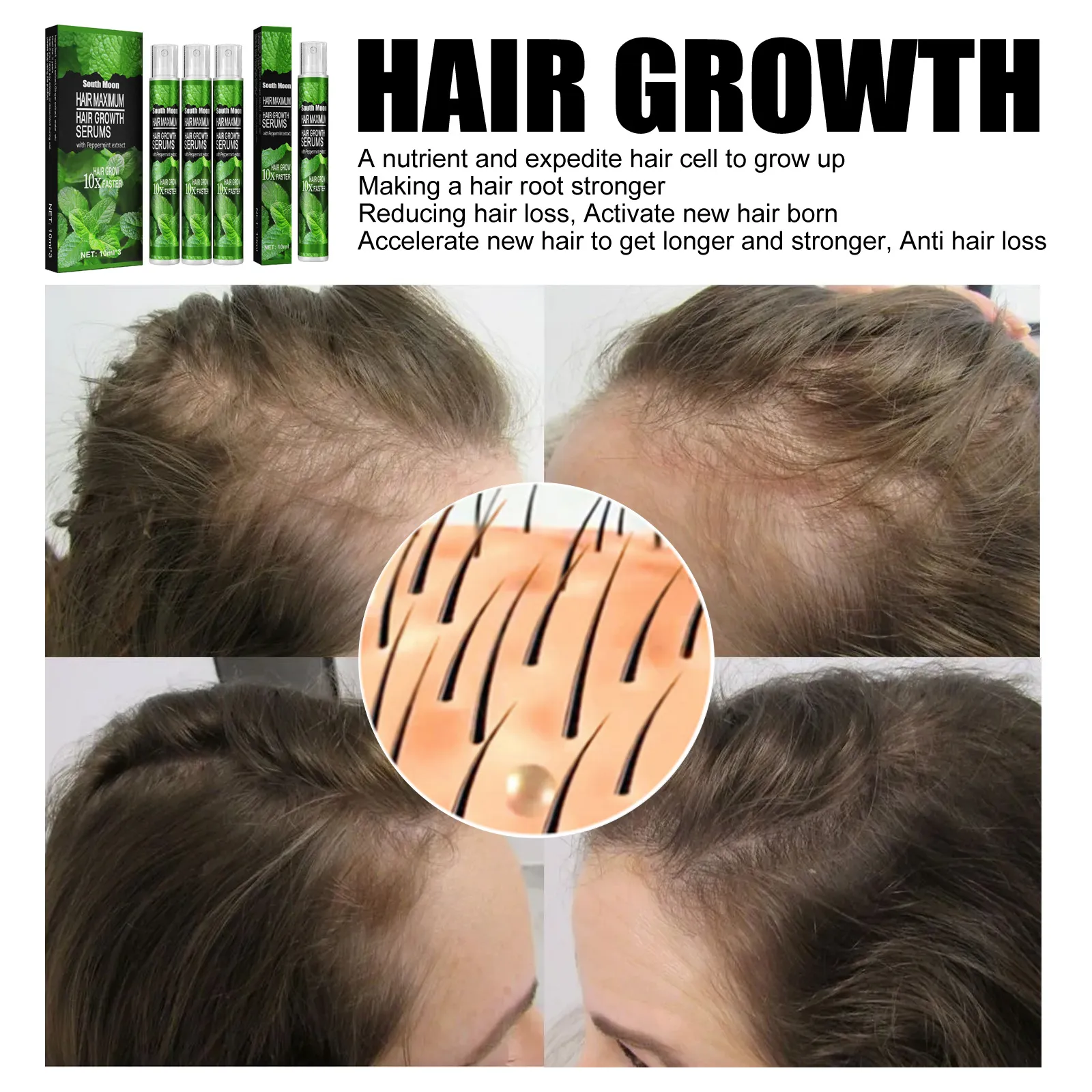 Fast DeliveryAnti-hair Loss, Fast and Powerful Hair Growth Conditioner, Hair Growth Oil 100% Natural Treatment for Hair Loss, Promote Hair Growth for Men and Women, Mint Hair Growth Spray, Hair Growth Essence, Fast DeliveryAnti-hair Loss, Fast and Powerful Hair Growth Conditioner, Hair Growth Oil 100% Natural Treatment for Hair Loss, Promote Hair Growth for Men and Women, Mint Hair Growth Spray, Hair Growth Essence,