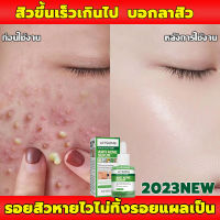 【 ผู้ขายในพื้นที่+พร้อมส่ง 】 อ่อนโยนไม่ระคายเคือง Jayusing 30ml เซรั่มแต้มสิว ซ่อมแซมรอยสิวลอกสิวเสี้ยน ครีมลดรอยสิว เจลแต้มสิว เซรั่มลดสิว