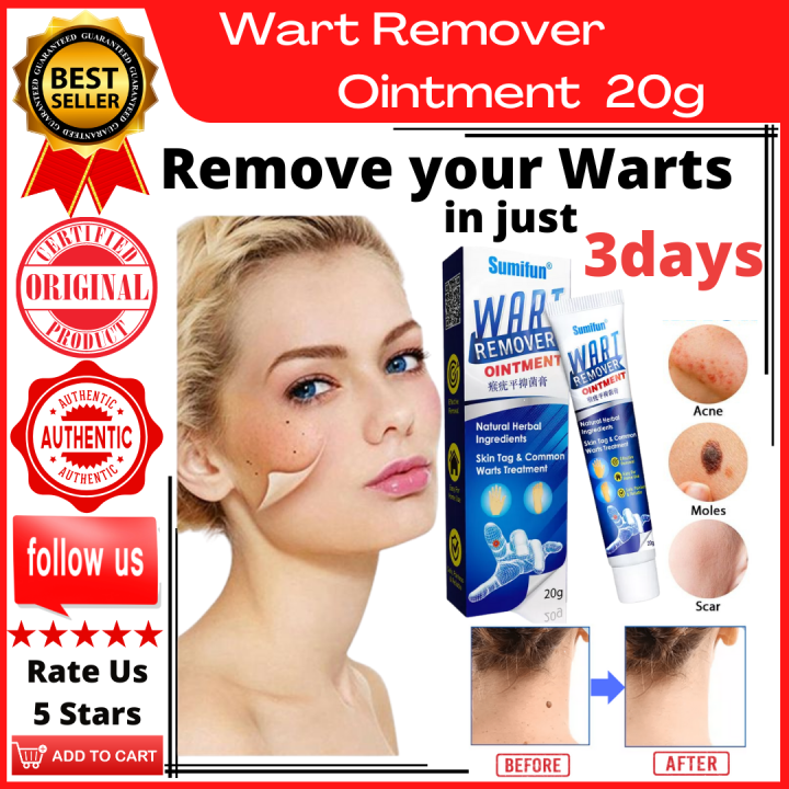 😍Wart Treatment Cream Warts Remover Antibacterial Ointment Skin Tag