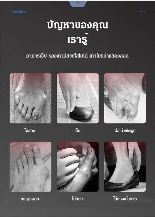 meimingzi-2-in-1-ชุดแก้ไขนิ้วโป้ง-valgus-อัพเกรดแล้ว