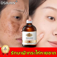 DSIUAN ครีมทาฝ้า 100ml กำจัดฝ้า จุดด่างดำ ฝ้า กระ กระจ่างใสผิว ลดเม็ดสีเมลานิน ต่อต้านริ้วรอย ครีมทาฝ้าลึก ครีมหน้าขาวใส ครีมทาฝ้ากระ ครีมฝ้ากระ ครีมทาหน้าขาว ครีมกระไวท์เทนนิ่ง ไวท์เทนนิ่งครีม บำรุงผิวหน้า ครีมแก้ฝ้าลึก ครีมรักษาฝ้า ครีมไวท์เทนนิ่ง