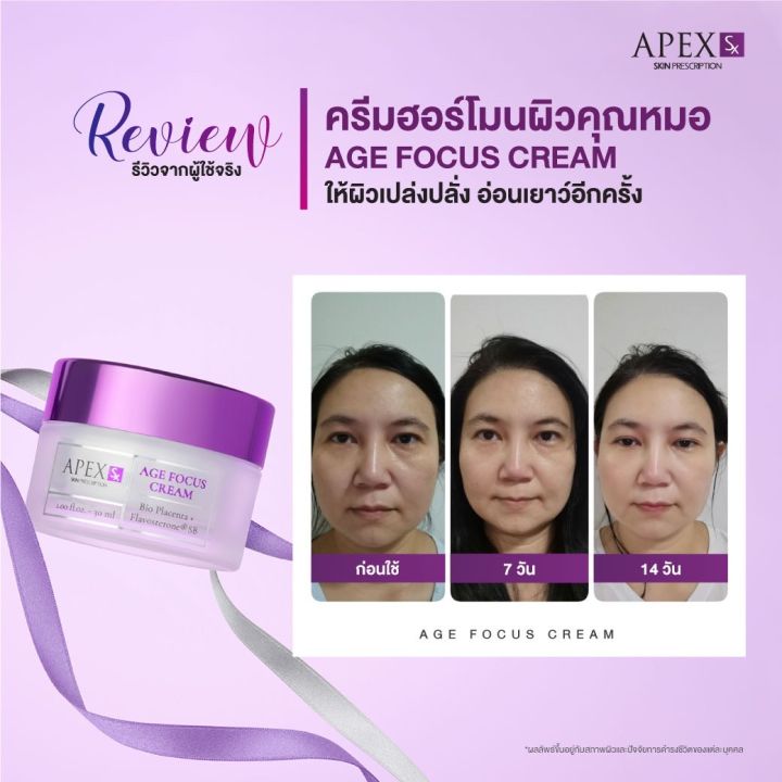 apex-sx-age-focus-cream-ครีมฮอร์โมนผิวสูตรคุณหมอเอเพ็กซ์-ผิวสดใสเปล่งปลั่ง-อ่อนเยาว์อีกครั้ง-30ml