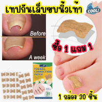 (ซื้อ1 แถม1) Toenail correction patch แผ่นแปะเล็บขบ เทปพลาสเตอร์ติดกันเล็บขบ เทปกันเล็บขบ 1 กล่อง 30 ชิ้น