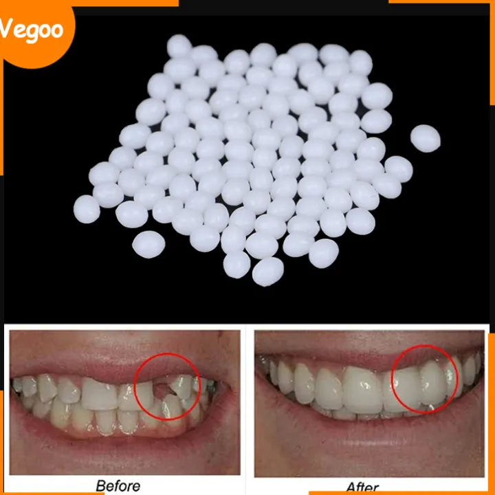 10g/100g Teeth And Gap Falseteeth Solid Glue Resin Denture