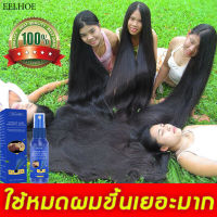 EELHIOE เซรั่มปลูกผม 30ml น้ำยาปลูกผม เร่งการงอกใหม่  ช่วยปรับปรุงผมร่วง เร่งการเจริญเติบโตของเส้นผม ยาปลูกผมของแท้ เซรั่มบำรุงผม สำหรับผมบาง นีโอแฮร์ของแท้ สเปรย์ปลูกผม น้ำยาปลูกผมชาย ปลูกผมเร่งด่วน น้ำยาเร่งผมยาว น้ำยาใส่ผม