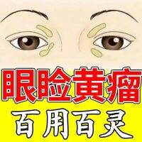 Xanthelasma eyelid xanthoma [not laser] xanthelasma Keyou ointment