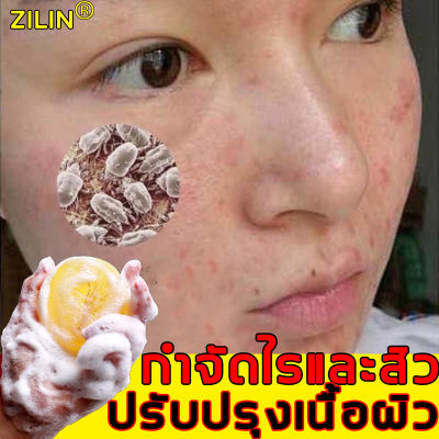 ZILIN สบู่สูตรลับโสม 100g สบู่กำจัดไร  มีเนื้อสัมผัสอ่อนโยนใช้ได้ทั้งตัว ป้องกันผิวมัน เหมาะสำหรับผิวที่มีปัญหาสิว สบู่อาบน้ำ สบู่ล้างเครื่องสำอางค์ สบู่หน้าเงา สบู่ลดสิวหน้า สบู่ก้อน สบู่ป้องกันแบคทีเรีย สบู่ล้างหน้า