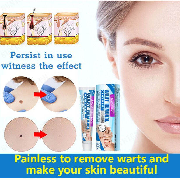 Sunrichh Jaysuing Cream for Skin Tag and Wart Removal on Armpits