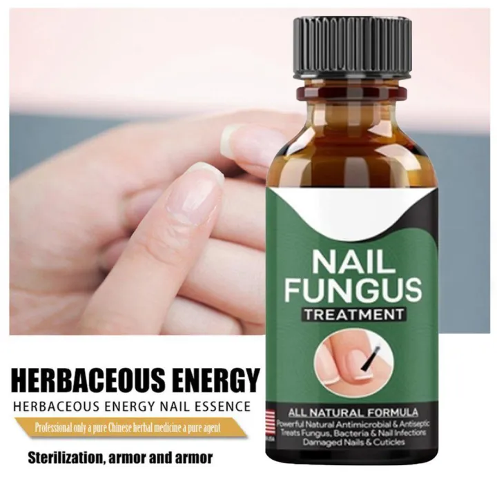 10/50ml Fast Nail Fungus Treatments Nail Repair Essences Serum Care ...