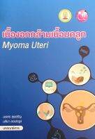 เนื้องอกกล้ามเนื้อมดลูก (MYOMA UTERI)