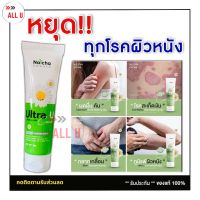 ของแท้/รีวิวเยอะ  [1หลอด] UltraU อัลตร้ายู ครีมณัชชา ครีมแก้โรคผิวหนัง ทาแก้คัน ผิวหนังอักเสบ กลากเกลื้อน เชื้อรา สะเก็ดเงิน 30g. AllU