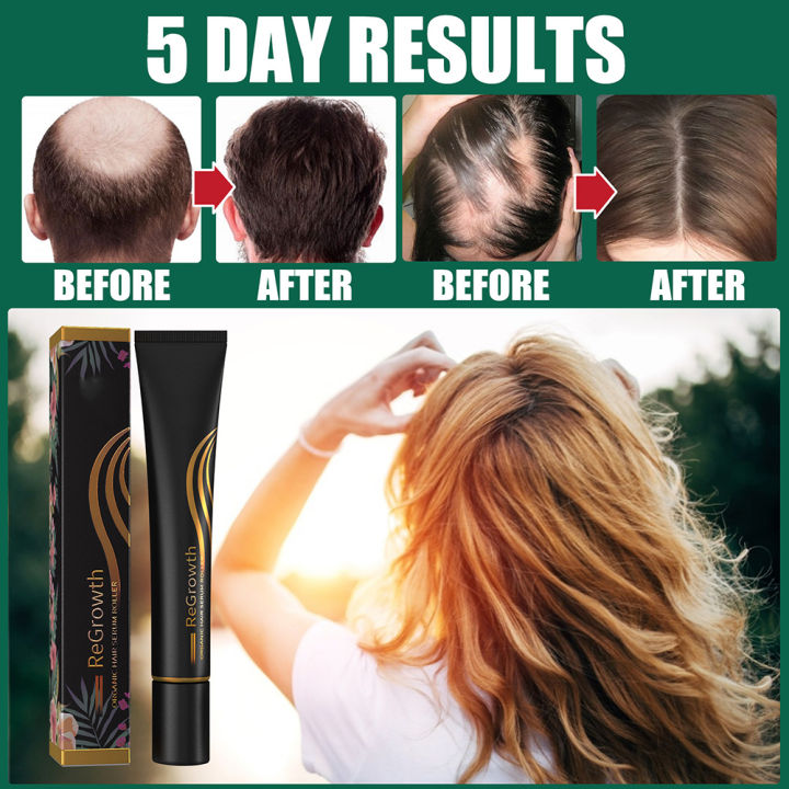 mus-triple-roll-on-massager-hair-growth-essences-for-men-amp-women-of-all-hair-types