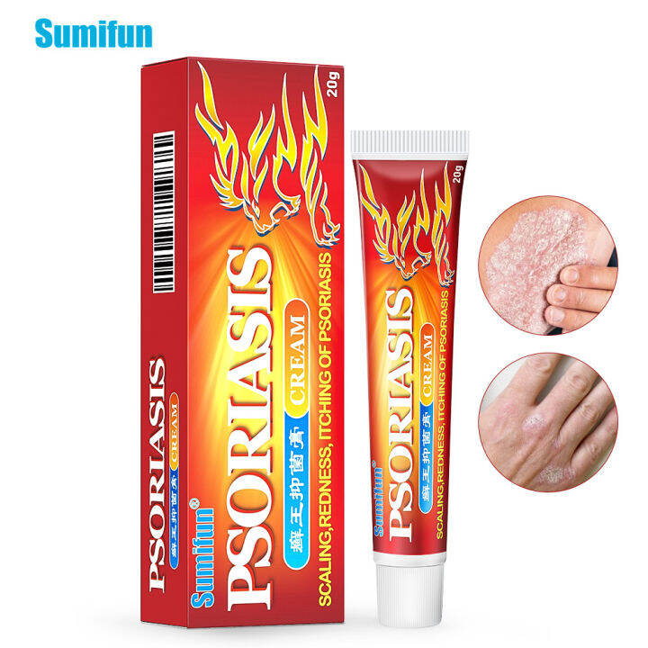 External Ointment Ringworm King Skin Itching Cream 