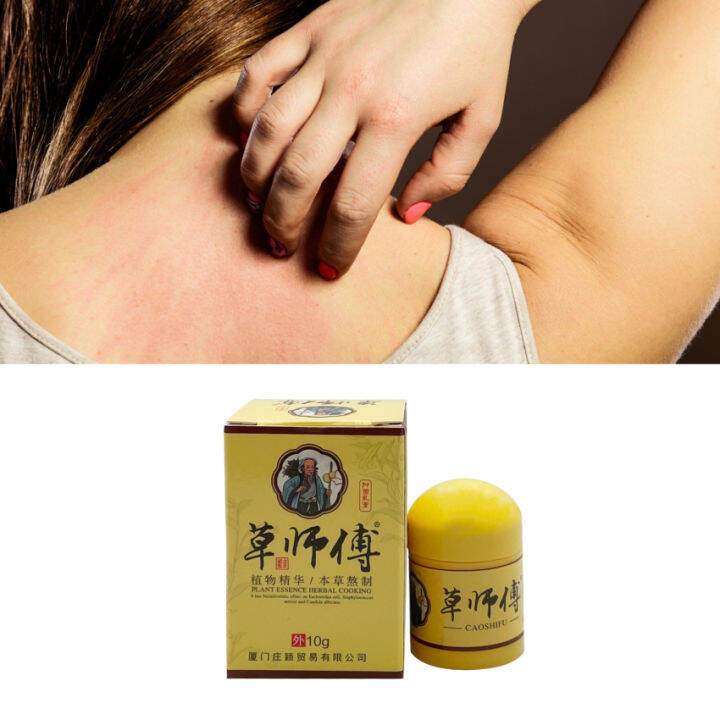 Caoshifu Psoriasis Skin Disease Treatment Cream Eczema Dermatitis Herbal Oint Ment Antibacterial 4505