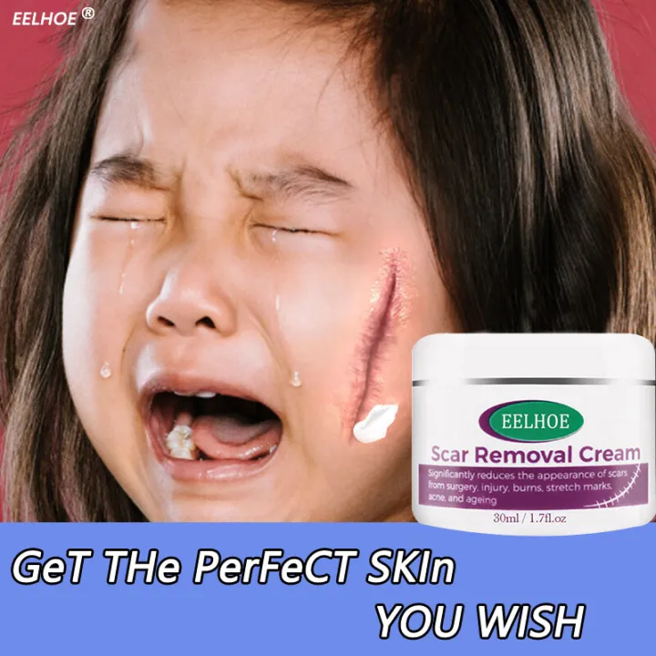 Original ALIVER Scar Repair Cream scar remover for old scar on legs