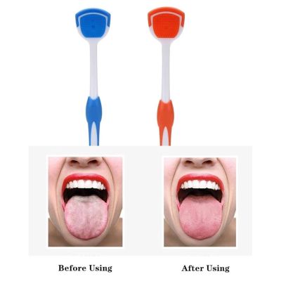 Tongue brush ที่แปรงลิ้น แปรงลิ้น แปรงขูดลิ้น ที่ทำความสะอาดลิ้น แปรงทำความสอาด ลิ้น ใช้ทำความสะอาดลิ้น  แปรงทำความสะอาดช่องปาก